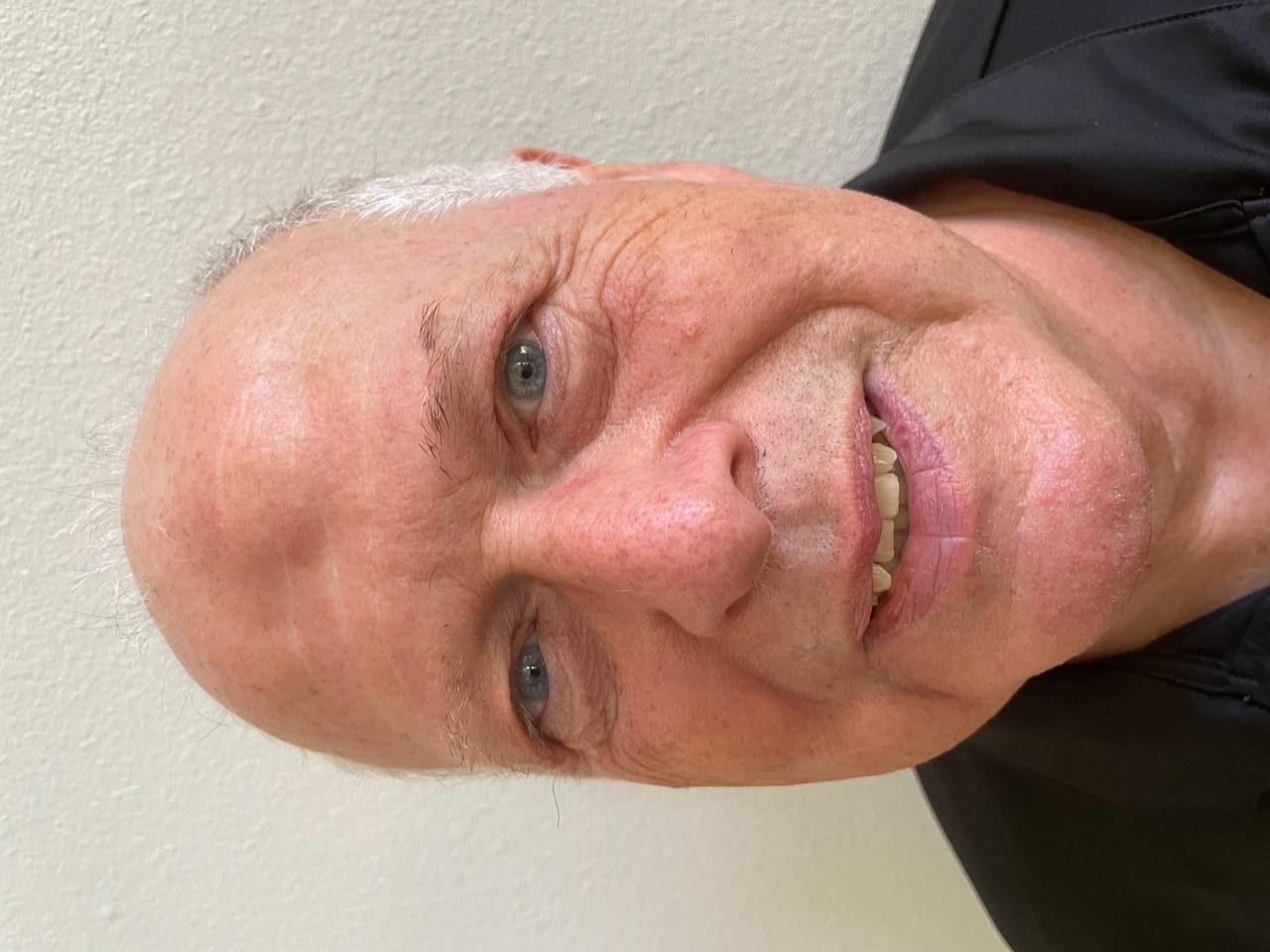 Allen Batchelder